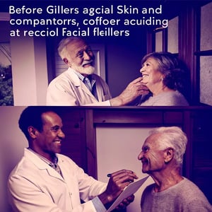 Facial Fillers for Age 70+: What to Know